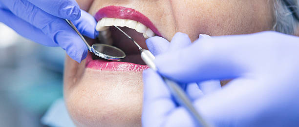 Best Emergency Root Canal Therapy in Lake Sconsin, WI